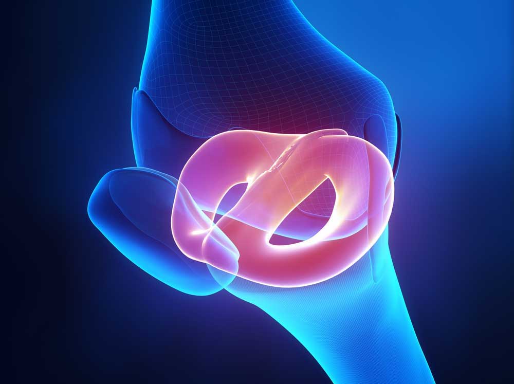 Lateral Meniscus Injuries | Lateral Meniscus Tear | Meniscus Tear Types | Orthopedic Knee Specialist | Manhattan, Brooklyn, New York City NY