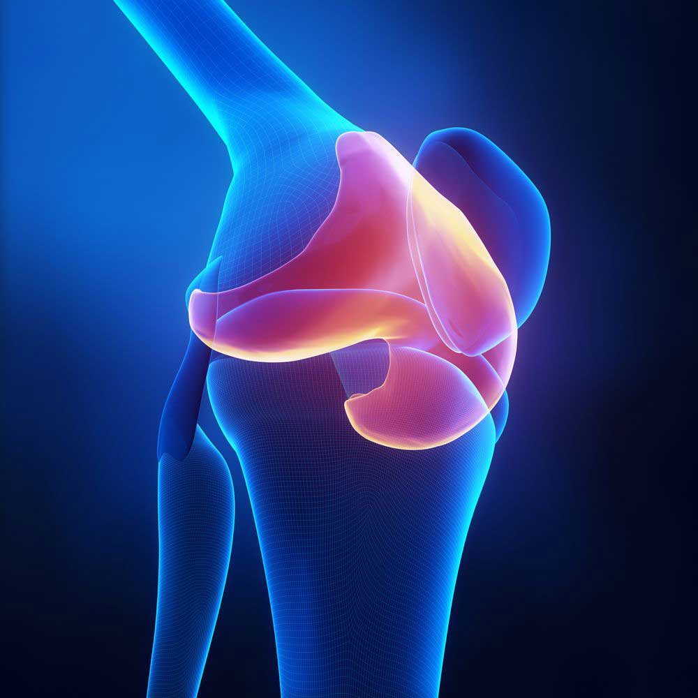 Articular Cartilage Injury | Knee Cartilage Damage | Shear Injury 