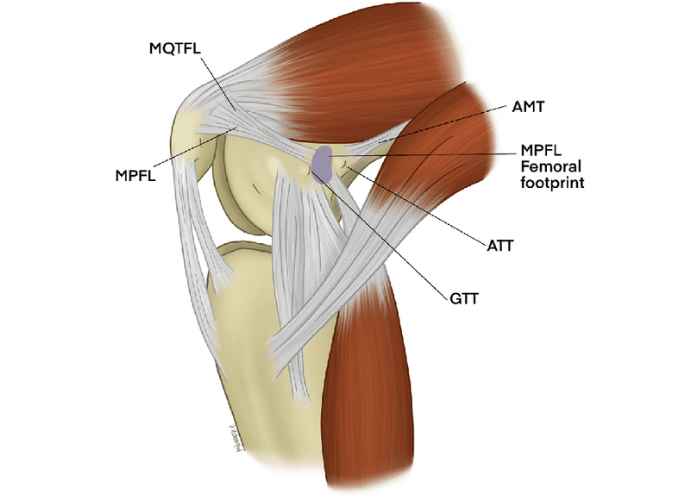 “Medial view of a flexed knee is shown – Anatomy of the MPFL AMT adductor magnus tendon” by Cg621 via Wikimedia Commons, licensed under CC BY 4.0. No modifications made.
