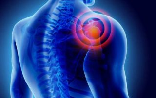 Shoulder Fracture | Manhattan NY