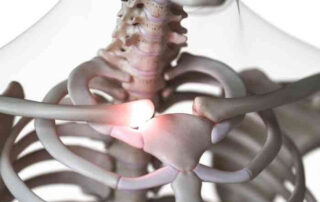 Sternoclavicular Joint Injury | Manhattan NY