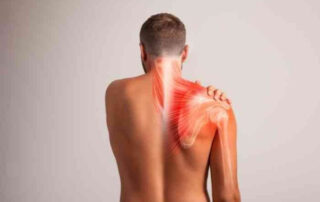 Snapping Scapula | Manhattan NY