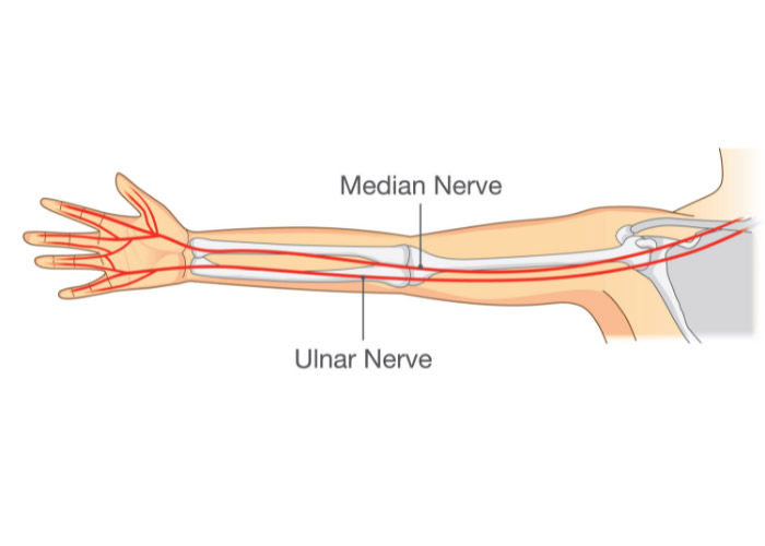 Ulnar Nerve Transposition | Pinched Elbow | Orthopedic Surgeon