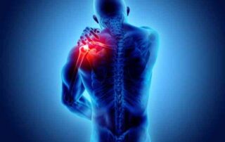 Shoulder Instability | Manhattan NY