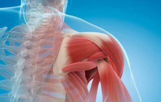 Shoulder Impingement | Manhattan NY